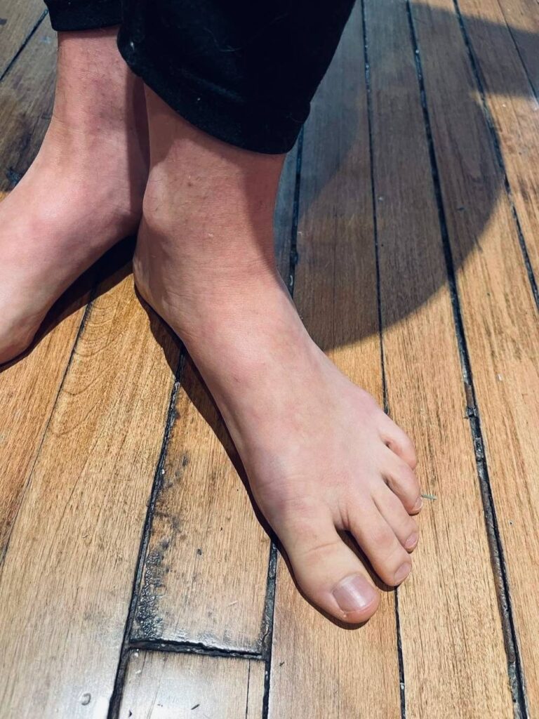 Hot and sexy feet OnlyFans – free nudes, naked, leaked